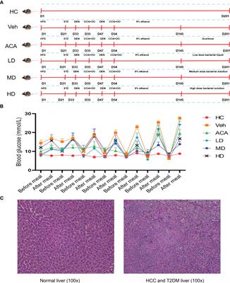 Lactobacillus brevis alleviates the progress of hepatocellular carcinoma and type 2 diabetes in mice model via interplay of gut microflora, bile acid and NOTCH 1 signaling